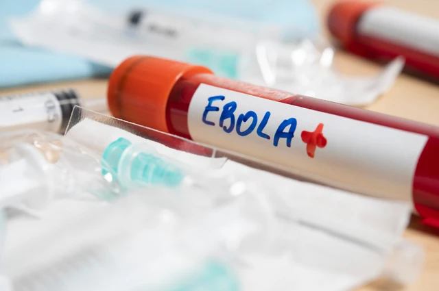 Épidémie d’Ebola