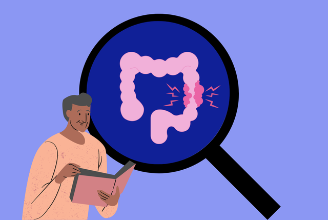 Commingeois, Commingeoises, le cancer du côlon, on en parle ?